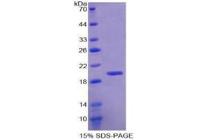 SDS-PAGE (SDS) image for RNA Binding Motif Protein 20 (RBM20) (AA 1089-1227) protein (His tag) (ABIN1099439)