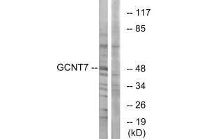 Western blot analysis of extracts from K562 cells, using GCNT7 antibody. (GCNT7 抗体)