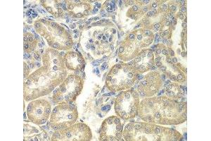 Immunohistochemistry of paraffin-embedded Rat kidney using ACSL5 Polyclonal Antibody at dilution of 1:100 (40x lens).