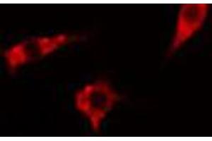 ABIN6267570 staining Hela cells by IF/ICC. (ADAM17 抗体  (pThr735))
