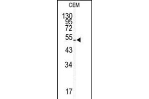 Western blot analysis of KLF5 antibody in CEM cell line lysates (35ug/lane) (KLF5 抗体  (AA 127-156))