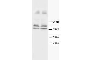 Western Blotting (WB) image for anti-Glial Fibrillary Acidic Protein (GFAP) antibody (ABIN1107345) (GFAP 抗体)