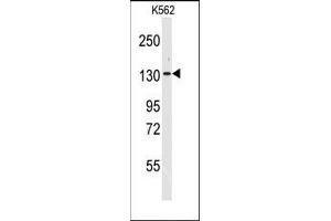 Image no. 1 for anti-Valyl-tRNA Synthetase (VARS) (N-Term) antibody (ABIN360195) (VARS 抗体  (N-Term))