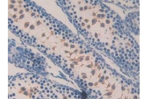 Detection of MGEA5 in Mouse Testis Tissue using Polyclonal Antibody to Meningioma Expressed Antigen 5 (MGEA5) (MGEA5 抗体  (AA 83-222))