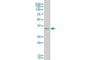 CXCR4 monoclonal antibody (M04), clone 2G9. (CXCR4 抗体  (AA 1-46))