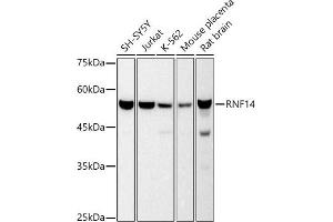 Western blot analysis of extracts of various cell lines, using RNF14 antibody (ABIN7270060) at 1:500 dilution.