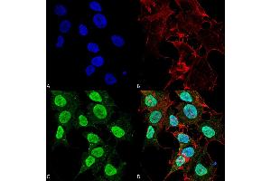 Immunofluorescence (fixed cells) (IF/ICC) image for anti-Calcium Channel, Voltage-Dependent, L Type, alpha 1C Subunit (CACNA1C) (AA 1507-1733) antibody (PE) (ABIN2485661)