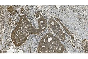 IHC analysis of U2AF65/U2AF2 using anti U2AF65/U2AF2 antibody (ABIN7600794). (U2AF2 抗体  (AA 238-470))