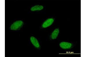 Immunofluorescence of purified MaxPab antibody to RBM23 on HeLa cell. (RBM23 抗体  (AA 1-424))