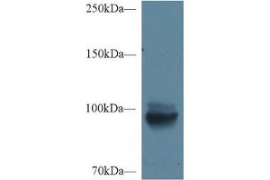 Detection of MEP1a in Mouse Kidney lysate using Polyclonal Antibody to Meprin A Alpha (MEP1a) (MEP1A 抗体  (AA 219-463))