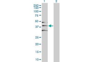Western Blot analysis of CDK2 expression in transfected 293T cell line by CDK2 MaxPab polyclonal antibody. (CDK2 抗体  (AA 1-298))