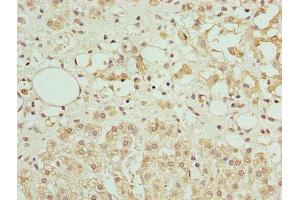 Immunohistochemistry of paraffin-embedded human adrenal gland tissue using ABIN7144341 at dilution of 1:100 (Antizyme Inhibitor 1 抗体  (AA 101-400))