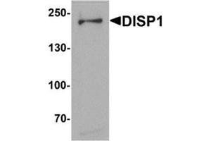 Western blot analysis of DISP1 in 3T3 cell lysate with DISP1 Antibody at (A) 1 and (B) 2 µg/ml. (DISP1 抗体  (N-Term))