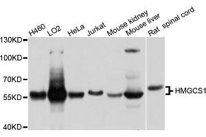 Western blot analysis of extracts of various cell lines, using HMGCS1 antibody. (HMGCS1 抗体)