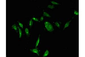 Immunofluorescent analysis of Hela cells using ABIN7172123 at dilution of 1:100 and Alexa Fluor 488-congugated AffiniPure Goat Anti-Rabbit IgG(H+L) (TYMS 抗体  (AA 2-54))