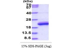 SDS-PAGE (SDS) image for Lipocalin 1 (LCN1) (AA 19-176) protein (His tag) (ABIN5853883) (Lipocalin 1 Protein (LCN1) (AA 19-176) (His tag))