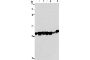 Western Blotting (WB) image for anti-Adenylate Kinase 2 (AK2) antibody (ABIN2422842) (Adenylate Kinase 2 抗体)