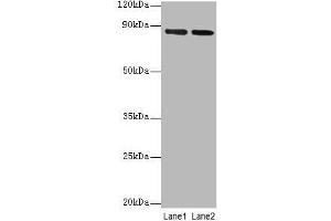 Western blot All lanes: FOLH1 antibody at 2 μg/mL Lane 1: U251 whole cell lysate Lane 2: PC-3 whole cell lysate Secondary Goat polyclonal to rabbit IgG at 1/10000 dilution Predicted band size: 85, 13, 10, 78, 83, 81, 79, 51 kDa Observed band size: 85 kDa (PSMA 抗体  (AA 48-750))