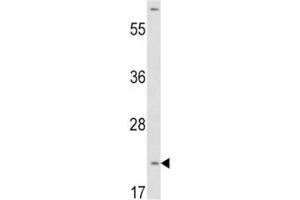 Western Blotting (WB) image for anti-Von Hippel-Lindau Tumor Suppressor, E3 Ubiquitin Protein Ligase (VHL) (AA 43-71) antibody (ABIN3029605)