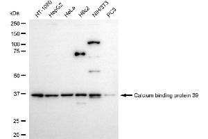 anti-Calcium Binding Protein 39 (CAB39) antibody
