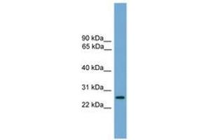 Image no. 1 for anti-Leucine Rich Repeat Containing 3 (LRRC3) (AA 107-156) antibody (ABIN6744812) (LRRC3 抗体  (AA 107-156))