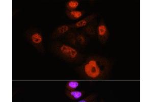 Immunofluorescence analysis of HeLa cells using Phospho-YAP1(S127) Polyclonal Antibody at dilution of 1:100 (40x lens). (YAP1 抗体  (pSer127))