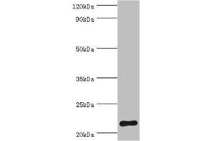 Western blot All lanes: Suppressor of cytokine signaling 2 antibody at 2 μg/mL + HepG2 whole cell lysate Secondary Goat polyclonal to rabbit IgG at 1/10000 dilution Predicted band size: 22 kDa Observed band size: 22 kDa (SOCS2 抗体  (AA 1-198))