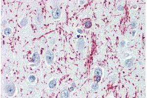Human Brain, Cortex (formalin-fixed, paraffin-embedded) stained with MBP antibody ABIN364503 at 1:100 followed by biotinylated goat anti-rabbit IgG secondary antibody ABIN481713, alkaline phosphatase-streptavidin and chromogen. (MBP 抗体)