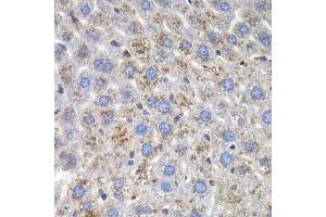 Immunohistochemistry of paraffin-embedded mouse liver using SND1 antibody at dilution of 1:100 (40x lens). (SND1 抗体)