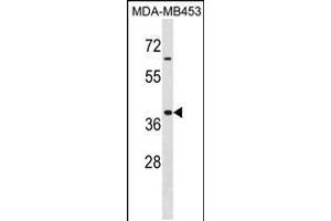 Western blot analysis in MDA-MB453 cell line lysates (35ug/lane). (HOXA9 抗体  (AA 160-189))