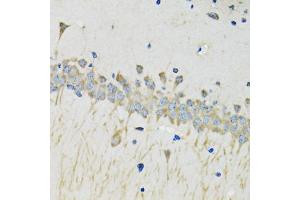 Immunohistochemistry of paraffin-embedded mouse brain using SERPINA4 antibody (ABIN5975715) at dilution of 1/100 (40x lens). (SERPINA4 抗体)