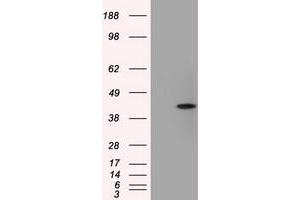 Image no. 8 for anti-Acetyl-CoA Acetyltransferase 2 (ACAT2) antibody (ABIN1496397) (ACAT2 抗体)