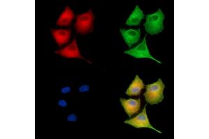 ABIN7095232 and ABIN7099289 staining  cells by IF/ICC.