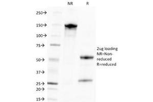 SDS-PAGE Analysis of Purified, BSA-Free CMV Antibody (clone CMV100). (Cytomegalovirus (CMV) 抗体)