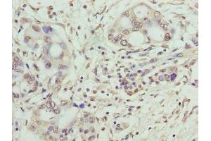 Immunohistochemistry (IHC) image for anti-Synaptojanin 2 Binding Protein (SYNJ2BP) (AA 1-117) antibody (ABIN7171128)