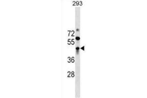 Western blot analysis in 293 cell line lysates (35 ug/ml) using. (ZBTB32 抗体  (AA 96-125) (APC))