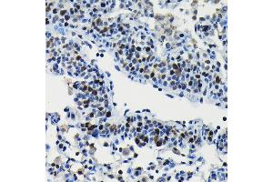 Immunohistochemistry (IHC) image for anti-AT Rich Interactive Domain 3A (BRIGHT-Like) (ARID3A) (AA 324-593) antibody (ABIN6137102)