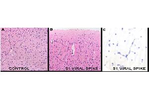 IHC Results in mice after tail vein injection of spike S1 subunit. (SARS-CoV-2 Spike S1 抗体)