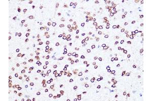 Immunohistochemistry of paraffin-embedded rat brain using Lamin B2 Rabbit mAb (ABIN1679310, ABIN3019324, ABIN3019325 and ABIN7101750) at dilution of 1:100 (40x lens). (Lamin B2 抗体)