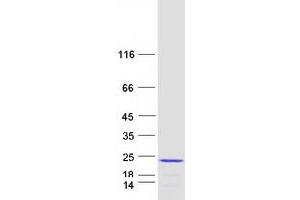 Validation with Western Blot