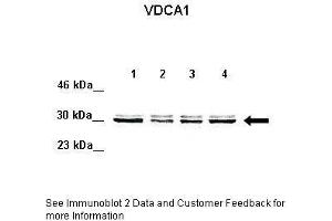 Western Blotting (WB) image for anti-Voltage-Dependent Anion Channel 1 (VDAC1) (C-Term) antibody (ABIN2776153)