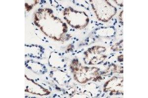 Immunohistochemical analysis of MOB3C staining in human kidney formalin fixed paraffin embedded tissue section. (MOBKL2C 抗体)