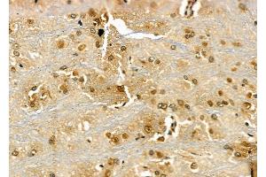 ABIN6266313 and ABIN6277430 at 1/100 staining Rat brain tissue by IHC-P. (RAD52 抗体  (Internal Region))