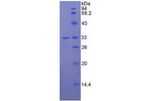 SDS-PAGE analysis of Human Jagged 2 Protein. (JAG2 蛋白)
