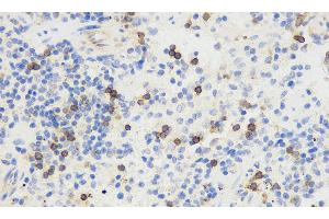 Immunohistochemistry analysis of paraffin-embedded mouse spleen using THY1 Polyclonal Antibody at dilution of 1:500. (CD90 抗体)