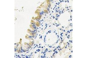Immunohistochemical analysis of RANBP5 staining in mouse lung formalin fixed paraffin embedded tissue section. (Importin 5 抗体)