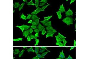 Immunofluorescence analysis of HeLa cells using SPINT2 Polyclonal Antibody (SPINT2 抗体)