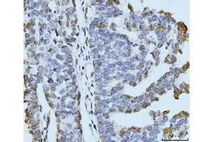 IHC analysis of ARL6IP6 using anti-ARL6IP6 antibody (ABIN7603020). (ARL6IP6 抗体  (Middle Region))