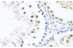 Immunohistochemistry of paraffin-embedded Rat testis using DDX46 Polyclonal Antibody at dilution of 1:100 (40x lens). (DDX46 抗体)