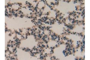 Detection of MMP12 in Mouse Lung Tissue using Polyclonal Antibody to Matrix Metalloproteinase 12 (MMP12) (MMP12 抗体  (AA 294-473))
